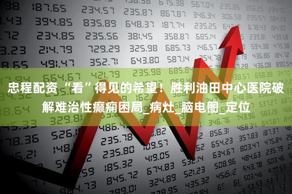 忠程配资 “看”得见的希望！胜利油田中心医院破解难治性癫痫困局_病灶_脑电图_定位